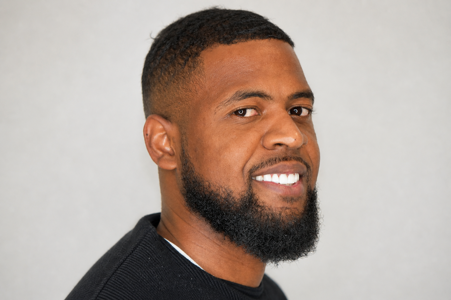 Closing a Front Tooth Gap – Diastema Closure
