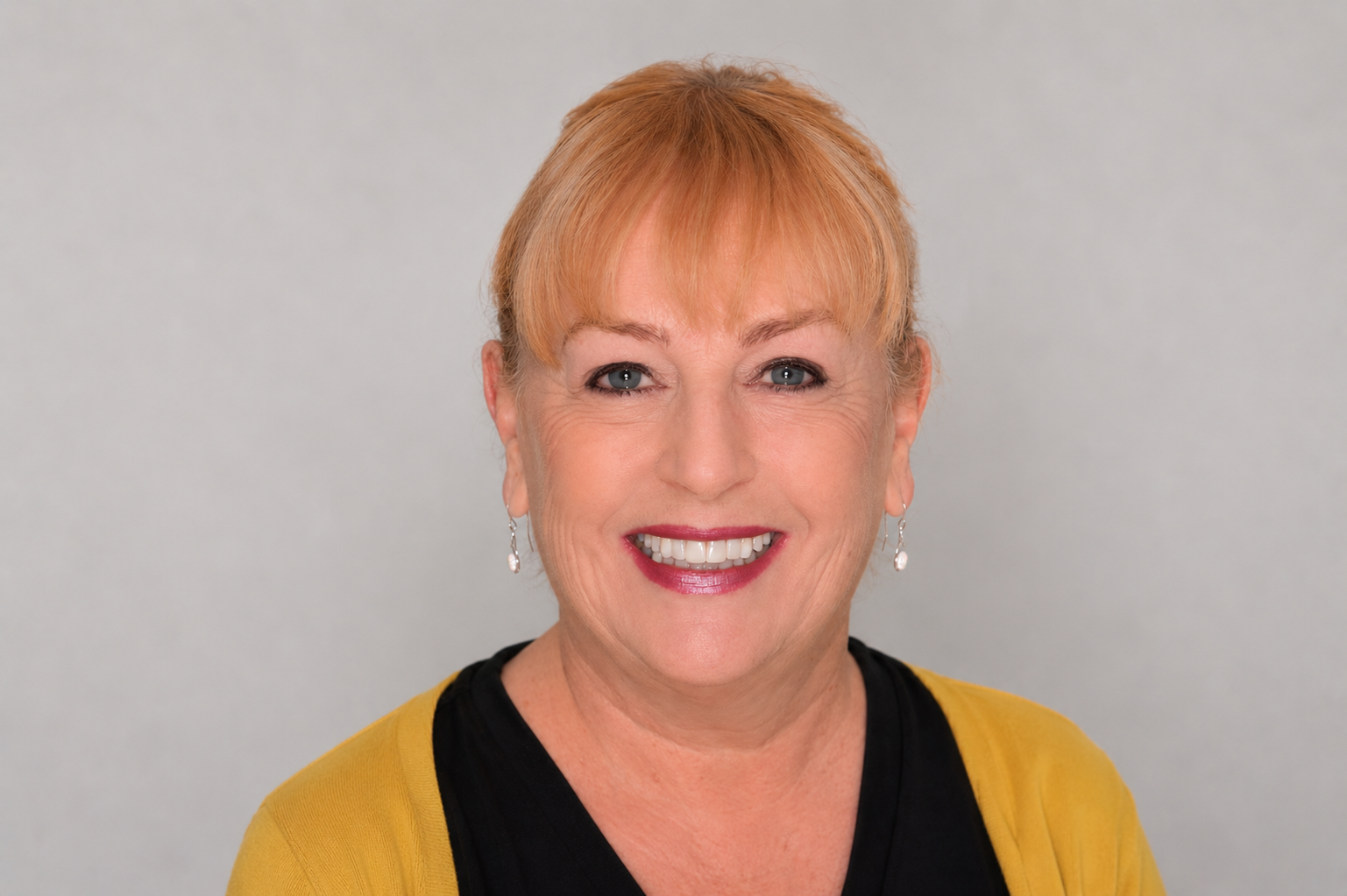 60th Birthday Smile Makeover Journey