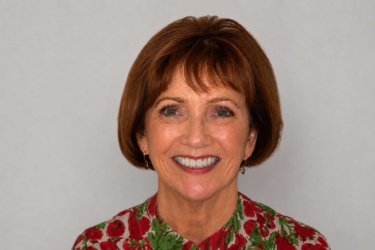 Replacing Ageing Veneers and a Bridge