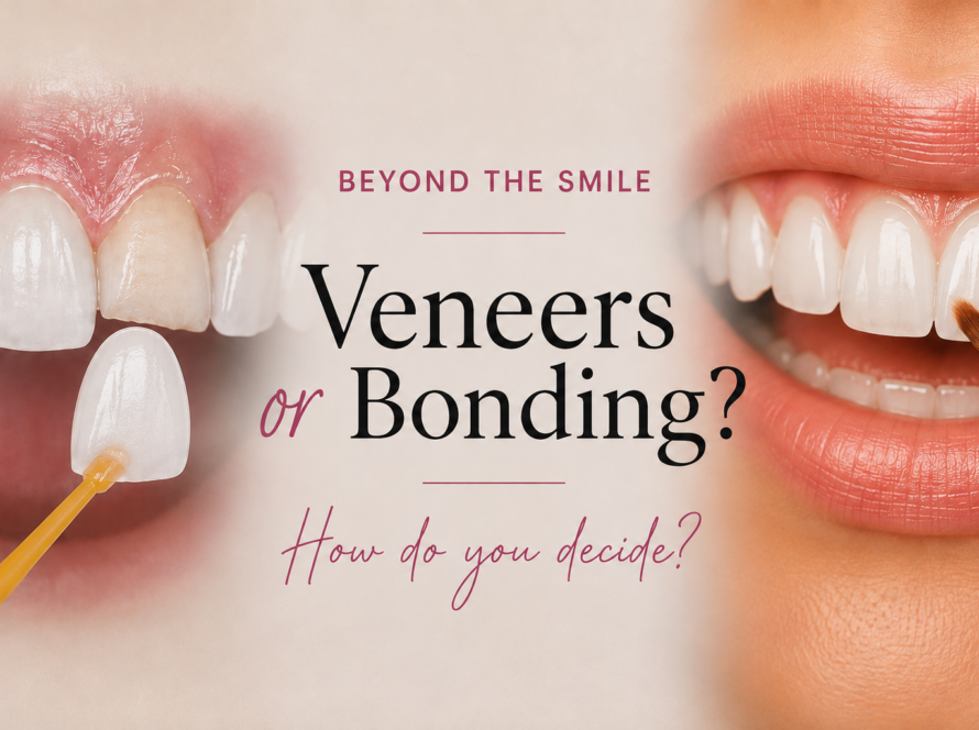 Veneers vs Composite Bonding