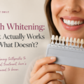 Teeth Whitening: What Actually Works and What Doesn’t?